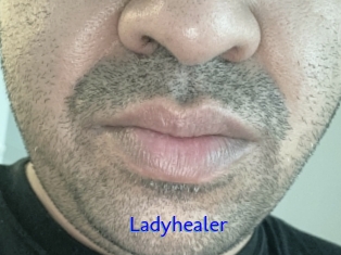 Ladyhealer